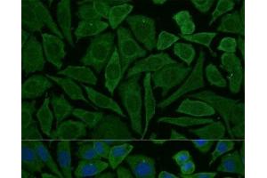 Immunofluorescence analysis of L929 cells using NDUFB2 Polyclonal Antibody at dilution of 1:100 (40x lens). (NDUFB2 Antikörper)