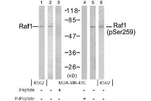 Image no. 2 for anti-V-Raf-1 Murine Leukemia Viral Oncogene Homolog 1 (RAF1) (pSer259) antibody (ABIN196618) (RAF1 Antikörper  (pSer259))