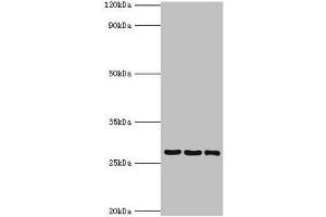 Western blot All lanes: 14-3-3 protein theta antibody at 4 μg/mL Lane 1: A549 whole cell lysate Lane 2: Mouse lung tissue Lane 3: HepG2 whole cell lysate Secondary Goat polyclonal to rabbit IgG at 1/10000 dilution Predicted band size: 28 kDa Observed band size: 28 kDa (14-3-3 theta Antikörper  (AA 1-245))