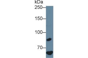 Detection of F8 in Human Hela cell lysate using Polyclonal Antibody to Coagulation Factor VIII (F8) (Factor VIII Antikörper  (AA 1854-1988))