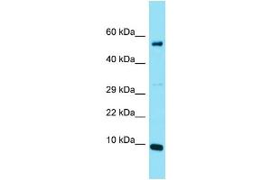Host: Rabbit Target Name: C20orf166 Sample Type: Jurkat Whole Cell lysates Antibody Dilution: 1. (C20orf166 Antikörper  (N-Term))