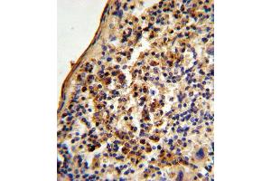 Formalin-fixed and paraffin-embedded mouse spleen tissue reacted with Ku70 Antibody (Center), which was peroxidase-conjugated to the secondary antibody, followed by DAB staining. (XRCC6 Antikörper  (AA 432-461))