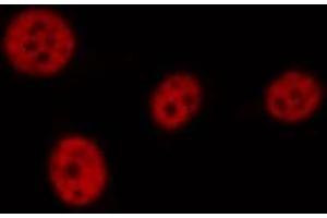 ABIN6276926 staining HT29 by IF/ICC. (LIG1 Antikörper  (Internal Region))