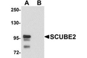 Western blot analysis of SCUBE2 in Daudi cell lysate with SCUBE2 antibody at 1 μg/ml in (A) the absence and (B) the presence of blocking peptide. (SCUBE2 Antikörper  (Center))