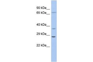 WB Suggested Anti-ASCL1 Antibody Titration: 0. (ASCL1 Antikörper  (Middle Region))