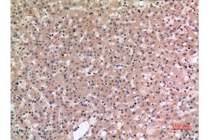 Immunohistochemistry (IHC) analysis of paraffin-embedded Human Liver, antibody was diluted at 1:100. (SLC10A1 Antikörper  (C-Term))