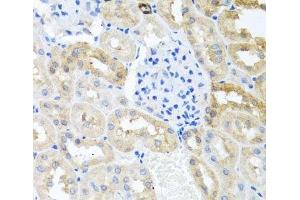 Immunohistochemistry of paraffin-embedded Rat kidney using MYLK Polyclonal Antibody at dilution of 1:100 (40x lens). (MYLK Antikörper)