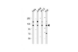 All lanes : Anti-REST Antibody (Center) at 1:2000 dilution Lane 1: Hela whole cell lysate Lane 2: Jurkat whole cell lysate Lane 3: PC-3 whole cell lysate Lane 4: Raji whole cell lysate Lysates/proteins at 20 μg per lane.