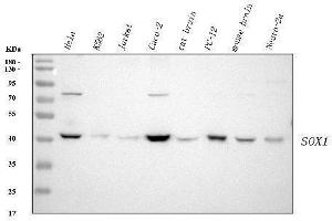 Western blot analysis of SOX1 using anti-SOX1 antibody (ABIN7606354).