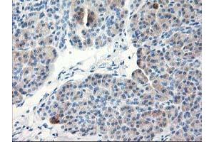 Immunohistochemical staining of paraffin-embedded Human pancreas tissue using anti-TBC1D21 mouse monoclonal antibody. (TBC1D21 Antikörper)