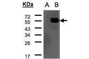 WB Image Western Blot analysis of ARHGAP1 expression in transfected 293T cell line by ARHGAP1 polyclonal antibody. (ARHGAP1 Antikörper  (N-Term))