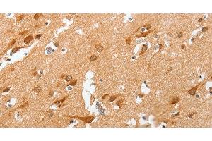 Immunohistochemistry of paraffin-embedded Human brain using cPLA2 Polyclonal Antibody at dilution of 1:50 (PLA2G4A Antikörper)