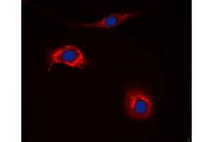 Immunofluorescent analysis of NPY2R staining in HeLa cells. (NPY2R Antikörper  (N-Term))