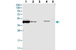 Western blot analysis of Lane 1: RT-4, Lane 2: U-251 MG, Lane 3: Human Plasma, Lane 4: Liver, Lane 5: Tonsil with FAM54A polyclonal antibody .