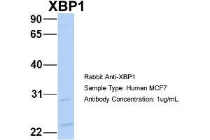 Host: Rabbit Target Name: NOP56 Sample Type: MCF7 Antibody Dilution: 1. (XBP1 Antikörper  (C-Term))