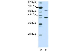 WB Suggested Anti-RARA Antibody Titration:  1. (Retinoic Acid Receptor alpha Antikörper  (N-Term))