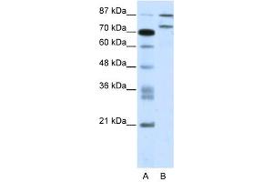 Western Blot showing ZNF709 antibody used at a concentration of 1-2 ug/ml to detect its target protein. (ZNF709 Antikörper  (N-Term))