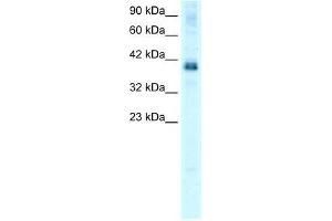 Human HepG2; WB Suggested Anti-TSC22D4 Antibody Titration: 0. (TSC22D4 Antikörper  (N-Term))