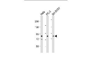 All lanes : Anti-DYRK1A Antibody (N-term) at 1:500-1:2000 dilution Lane 1: Hela whole cell lysate Lane 2: PC-3 whole cell lysate Lane 3: SH-SY5Y whole cell lysate Lysates/proteins at 20 μg per lane.