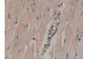 Immunohistochemistry (IHC) image for anti-ATPase, Na+/K+ Transporting, beta 3 Polypeptide (ATP1B3) (AA 61-273) antibody (ABIN7440134)