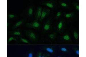 Immunofluorescence analysis of U-2 OS cells using ETS2 Polyclonal Antibody at dilution of 1:100. (ETS2 Antikörper)