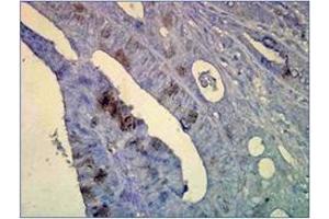 Immunohistochemistry (IHC) image for anti-Heat Shock Protein 70 (HSP70) antibody (ABIN263937) (HSP70 Antikörper)