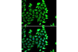 Immunofluorescence analysis of MCF-7 cells using IKZF3 antibody (ABIN6130489, ABIN6142290, ABIN6142291 and ABIN6223116). (IKZF3 Antikörper  (AA 280-450))