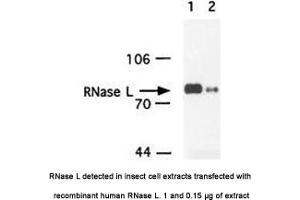 Image no. 1 for anti-Ribonuclease L (2',5'-Oligoisoadenylate Synthetase-Dependent) (RNASEL) antibody (ABIN363220) (RNASEL Antikörper)