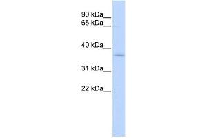 WB Suggested Anti-SFXN3 Antibody Titration:  0. (SFXN3 Antikörper  (Middle Region))