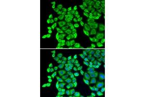 Immunofluorescence analysis of U20S cell using EEF1D antibody. (EEF1D Antikörper  (AA 1-160))