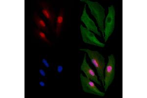 ABIN6261411 and ABIN6266531 staining  cells by IF/ICC. (E2F4 Antikörper  (N-Term))