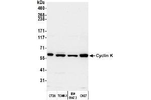 Western Blotting (WB) image for anti-Cyclin K (CCNK) (AA 530-580) antibody (ABIN7453581)