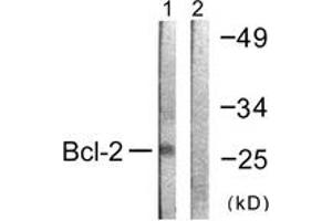 Western blot analysis of extracts from K562 cells, using BCL-2 (Ab-69) Antibody. (Bcl-2 Antikörper  (AA 46-95))