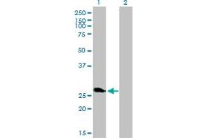 Western Blotting (WB) image for anti-Ring Finger Protein 114 (RNF114) (AA 1-229) antibody (ABIN466223) (RNF114 Antikörper  (AA 1-229))