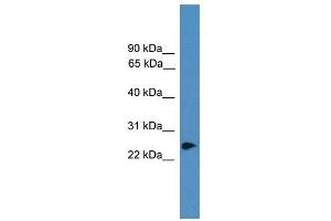 WB Suggested Anti-ZNF313  Antibody Titration: 0. (RNF114 Antikörper  (C-Term))