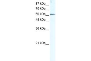 Western Blotting (WB) image for anti-Methyltransferase Like 3 (METTL3) antibody (ABIN2460997) (METTL3 Antikörper)