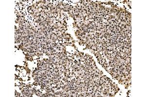 IHC analysis of SPHK1 using anti-SPHK1 antibody (ABIN7600168). (SPHK1 Antikörper  (AA 16-267))