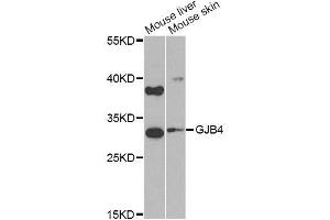 Western blot analysis of extracts of various cell lines, using GJB4 Antibody (ABIN6003620) at 1/1000 dilution. (GJB4 Antikörper)