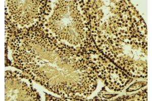 ABIN6269020 at 1/100 staining Mouse testis tissue by IHC-P. (TBP Antikörper  (N-Term))