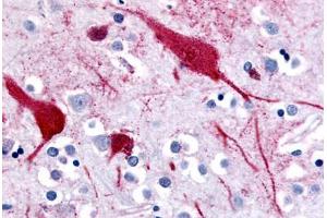 Human Brain, Cortex (formalin-fixed, paraffin-embedded) stained with SLC5A9 antibody ABIN213393 at 10 ug/ml followed by biotinylated goat anti-rabbit IgG secondary antibody ABIN481713, alkaline phosphatase-streptavidin and chromogen. (SLC5A9 Antikörper  (C-Term))