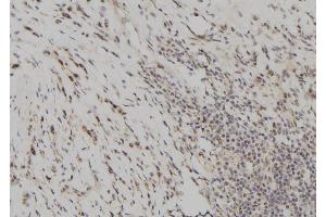 ABIN6261071 and ABIN6277699 at 1/100 staining Human gastric tissue by IHC-P. (CSTA Antikörper  (C-Term))