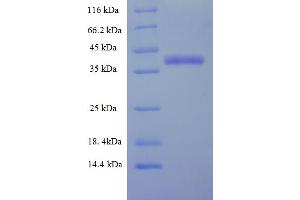 SDS-PAGE (SDS) image for Charged Multivesicular Body Protein 5 (CHMP5) (AA 1-219), (full length) protein (His-SUMO Tag) (ABIN5711871)