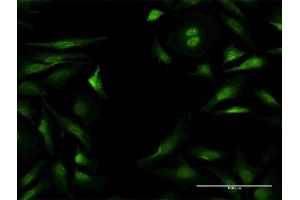 Immunofluorescence of purified MaxPab antibody to NLK on HeLa cell.