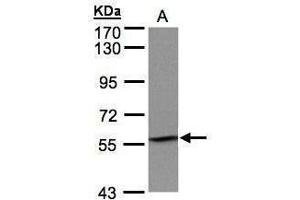 WB Image Sample(30 μg of whole cell lysate) A:H1299 7. (IMPDH2 Antikörper)