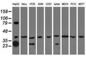 Image no. 1 for anti-Quinolinate Phosphoribosyltransferase (QPRT) antibody (ABIN1500530)