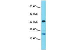 Host: Rabbit Target Name: TREML4 Sample Type: Jurkat Whole Cell lysates Antibody Dilution: 1. (TREML4 Antikörper  (C-Term))