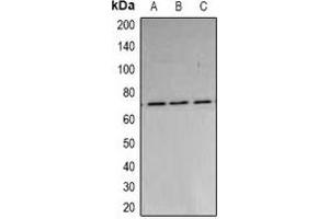 Western blot analysis of PARN expression in A549 (A), MCF7 (B), HepG2 (C) whole cell lysates. (PARN Antikörper)