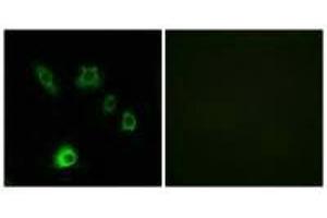 Immunofluorescence analysis of HuvEc cells, using FGF18 antibody. (FGF18 Antikörper)