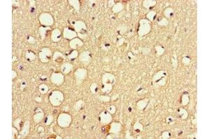 Immunohistochemistry of paraffin-embedded human brain tissue using ABIN7166372 at dilution of 1:100 (ZNF365 Antikörper  (AA 241-401))
