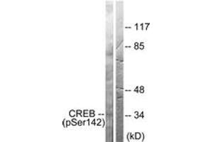 Western blot analysis of extracts from HeLa cells treated with PMA 125ng/ml 30', using CREB (Phospho-Ser142) Antibody. (CREB1 Antikörper  (pSer142))